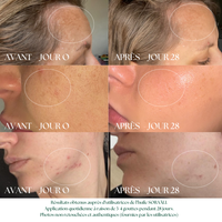 L'Huile N°1 contre les Rides et les Taches