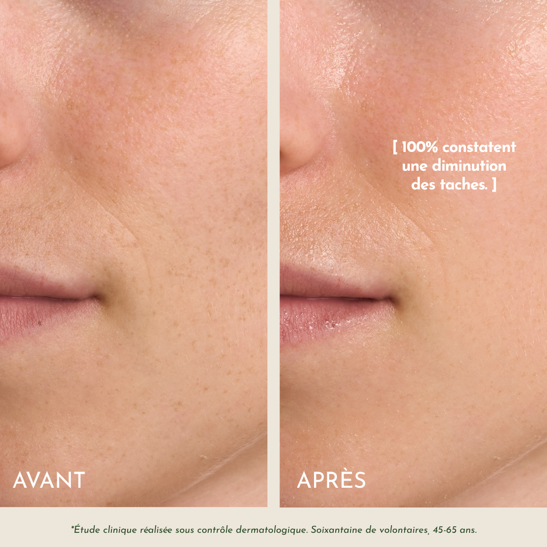 L'Huile Précieuse Anti-Âge