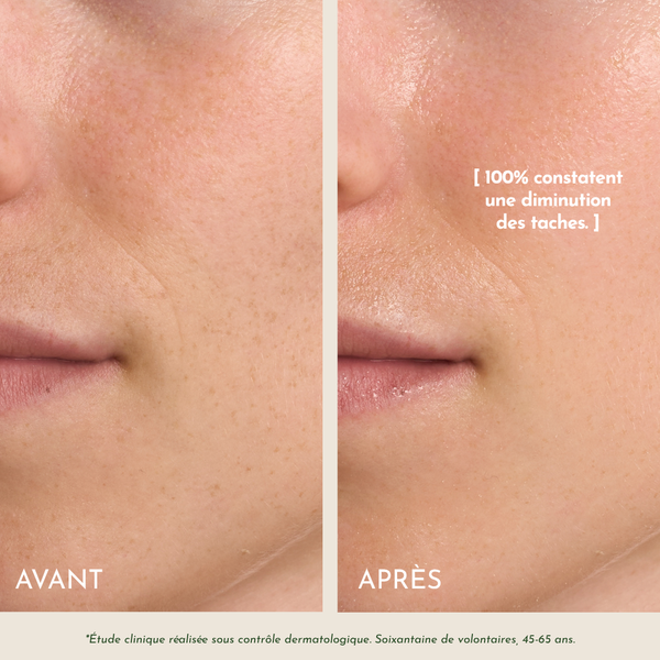 L'Huile Précieuse Anti-Âge